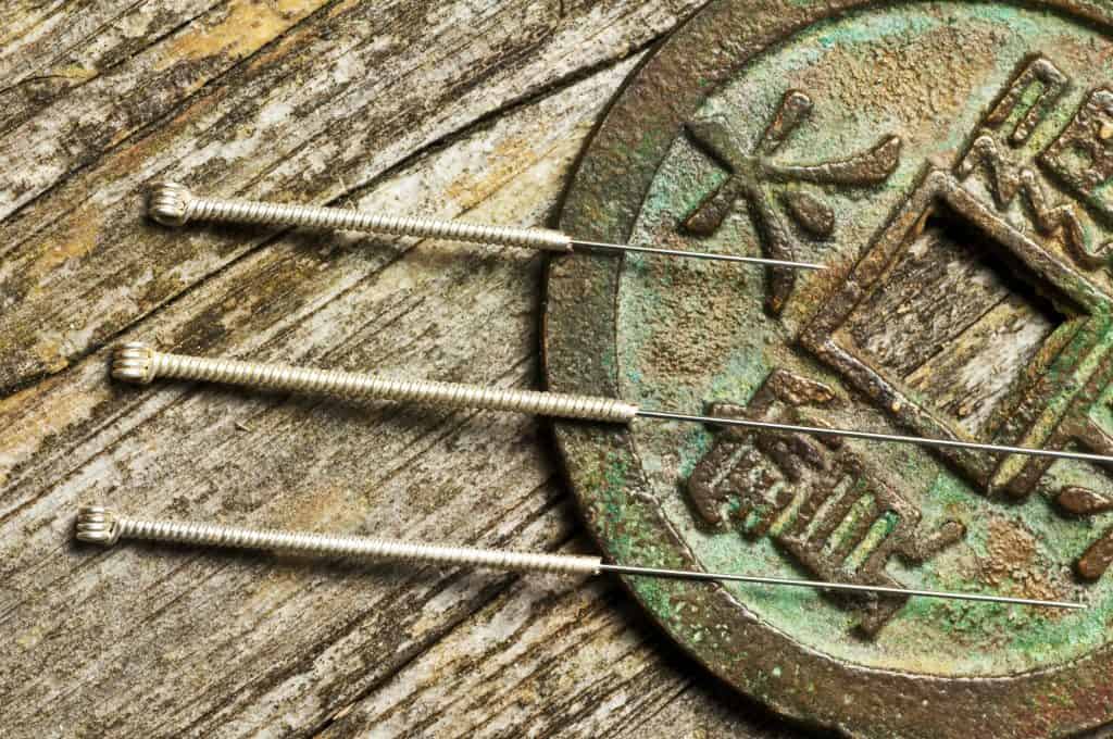 Chinese acupuncture needles